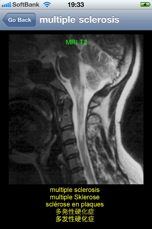 neuroradiology multilingual screenshot-3