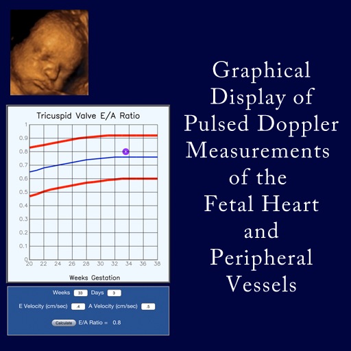 Fetal Heart Doppler icon