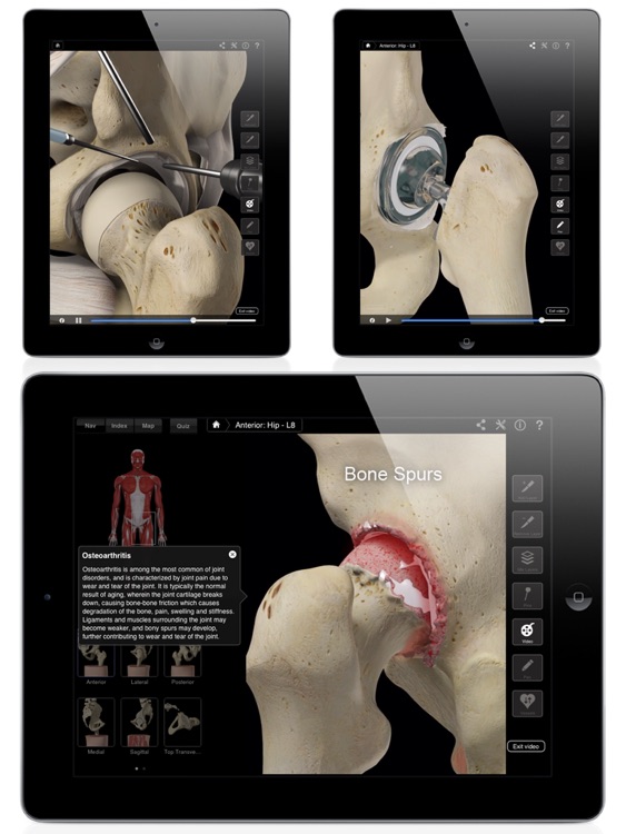 Hip Pro III for iPad