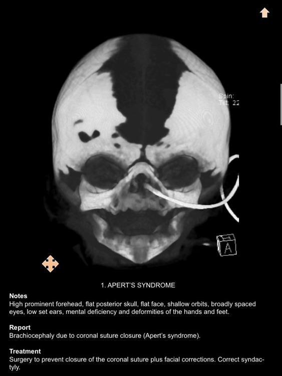 Exploring Essential Radiology