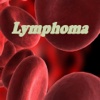 Lymphoma + Lymphoma Treatment and Diet