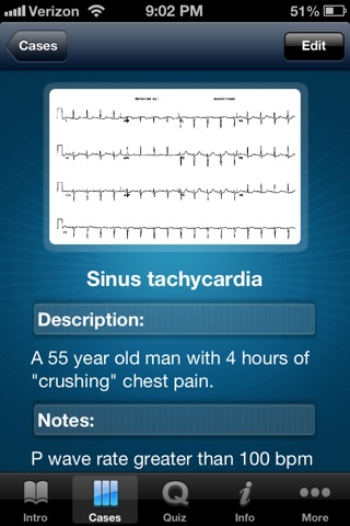 ECG - An Electrocardiogram Review for Healthcare Professionals screenshot 3