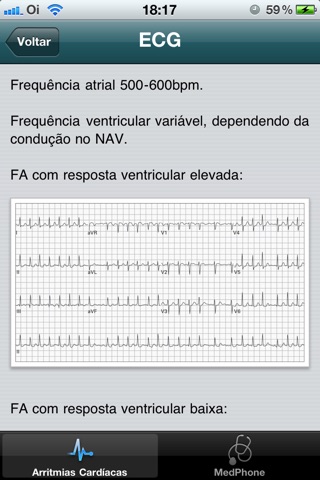 Arritmias Cardíacas screenshot 4