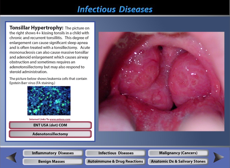 Oral Pathology