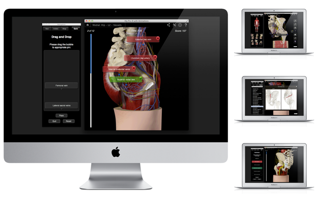 Hip Pro III with Animations(圖5)-速報App