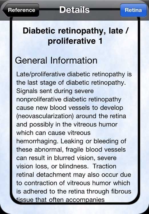 iEye Retina