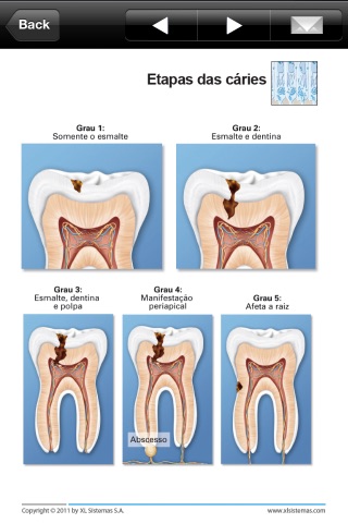 Miniatlas Odontologia screenshot 4