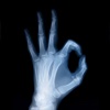 X ray for iPhone