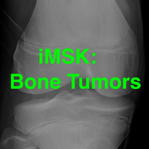 iMSK Bone Tumors
