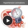 Hypertension animations