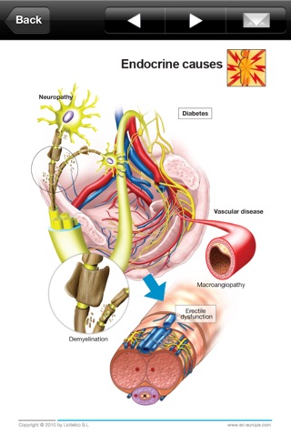 Miniatlas Erectile Dysfunction screenshot 3