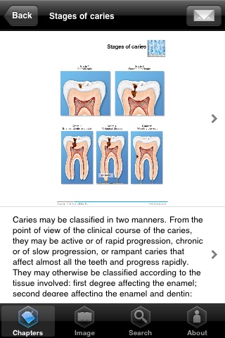 Miniatlas Dentistry screenshot 4