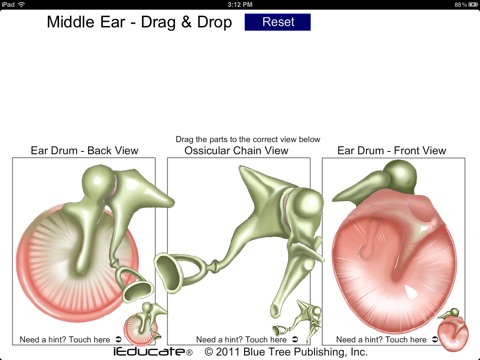 Middle Ear DnD screenshot 3