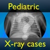 PediatricXR