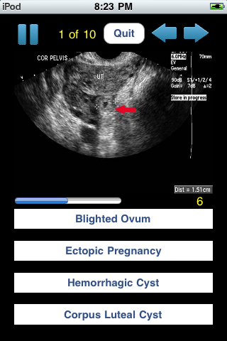 Sono Quiz OB-GYN screenshot 4