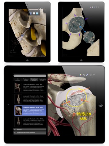 Orthopedic Patient Education screenshot 4