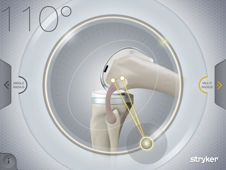Stryker Get Around Knee screenshot-3