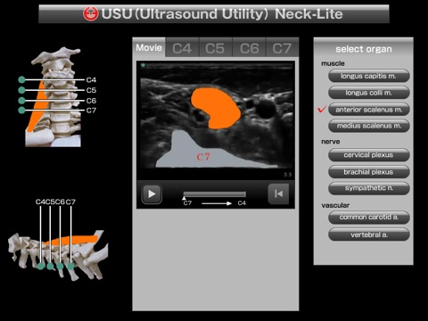USU neck-lite screenshot 3