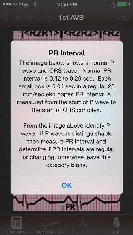 EKG Calculator screenshot-3