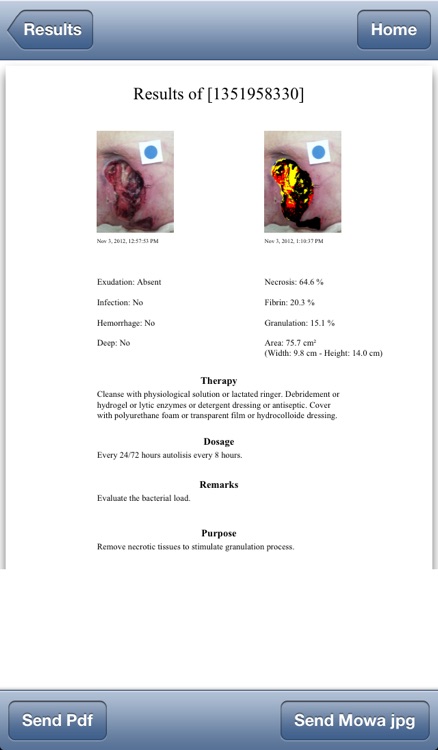 MOWA - Mobile Wound Analyzer - Wound Care Solution (Ulcers Management) screenshot-4