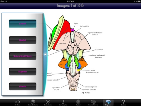 Anatomy Of The Brain 2D/3D screenshot 4