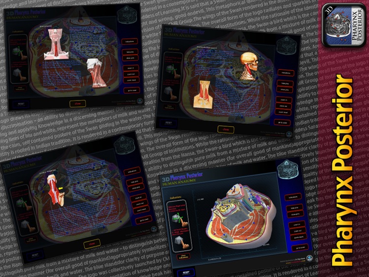 3D Pharynx Posterior screenshot-4