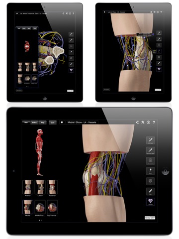 Elbow Pro III for iPad screenshot 4