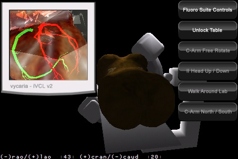 iVCLv2.0 - Cardiac screenshot 3