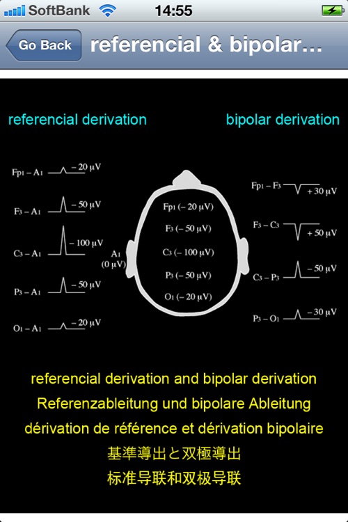 electroencephalography multilingual