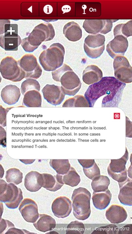 Smart Hematology screenshot-3