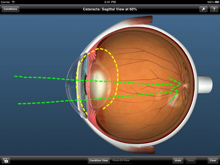 Jumpstart Optometry