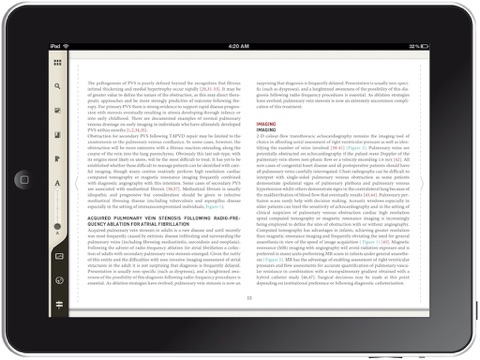 Percutaneous Interventional Cardiovascular Medicine: The PCR-EAPCI Textbook screenshot 2