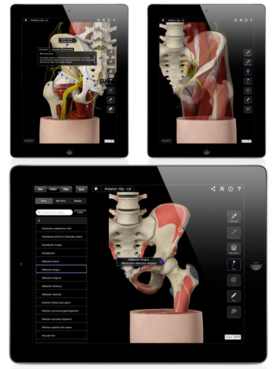 Hip Pro III for iPad screenshot-3