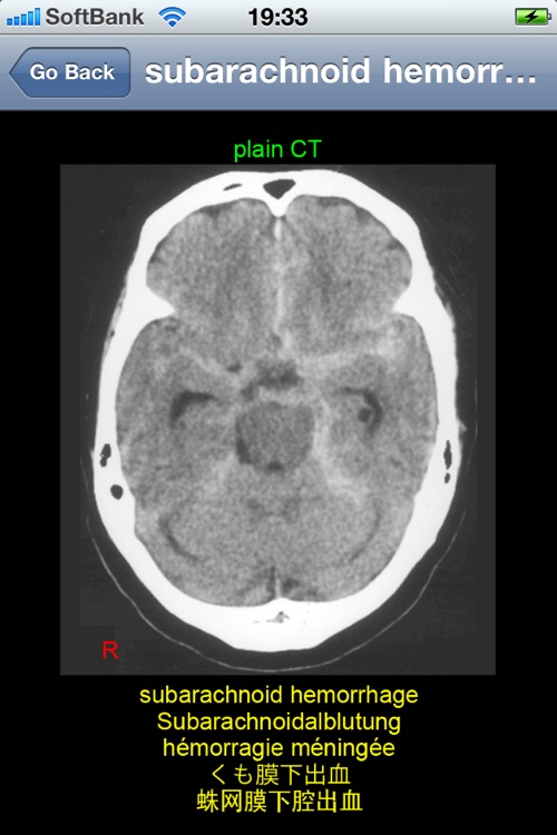 neuroradiology multilingual screenshot-4