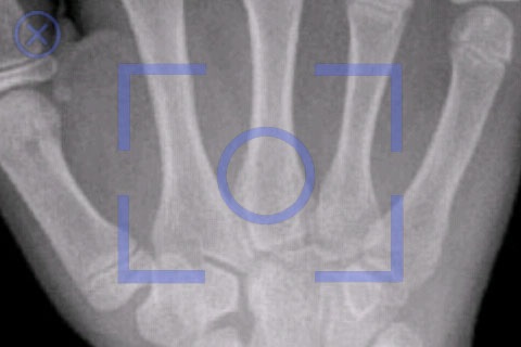 iRay Mobile X-Ray screenshot 4