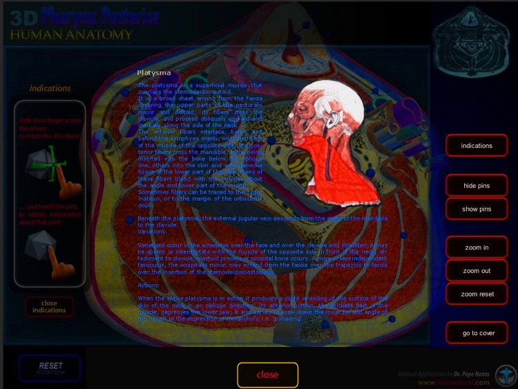 3D Pharynx Posterior screenshot-3