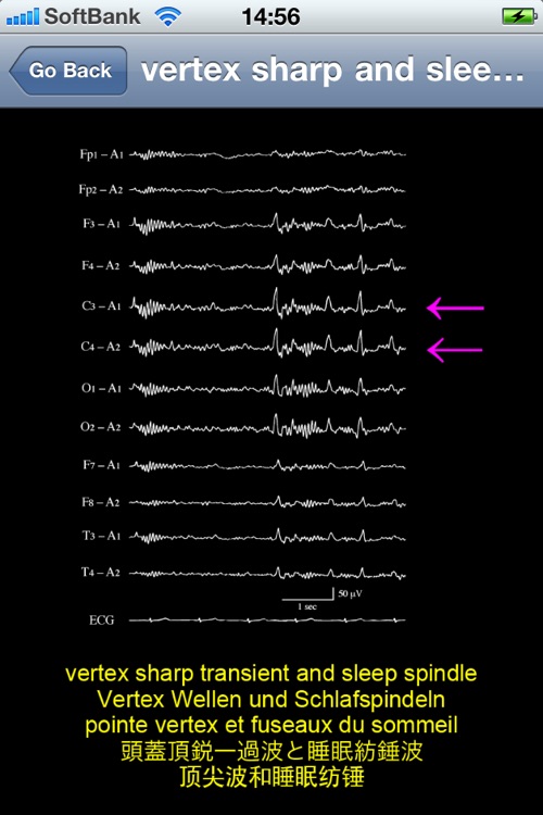 electroencephalography multilingual screenshot-3