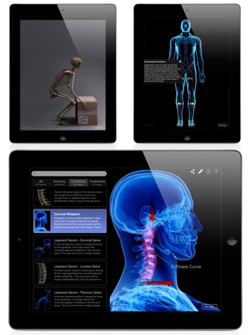 Orthopedic Patient Education screenshot 2