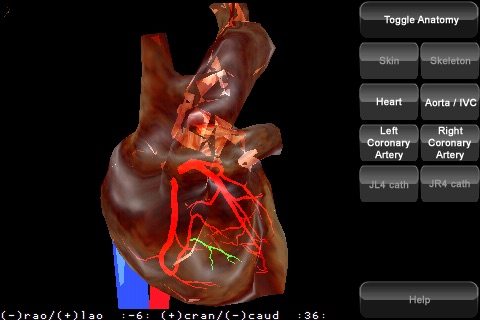 iVCLv2.0 - Cardiac screenshot 4