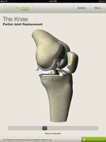 Biomet Virtual Bone Model screenshot 4