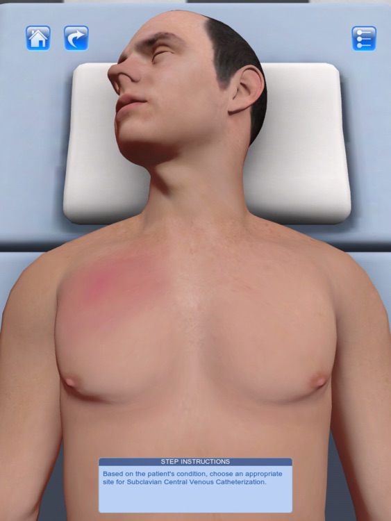 Safety Spotlight - Central Venous Catheterization