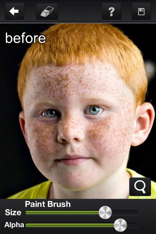 Pimple Remover HD