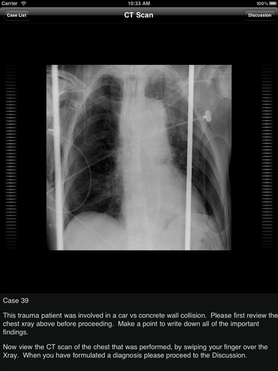 One Night in the ED