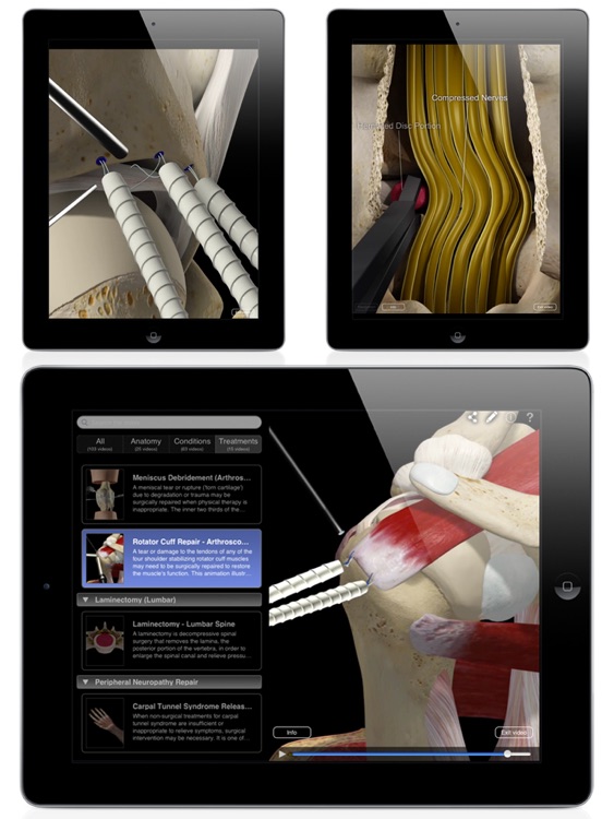 Orthopedic Patient Education screenshot-4