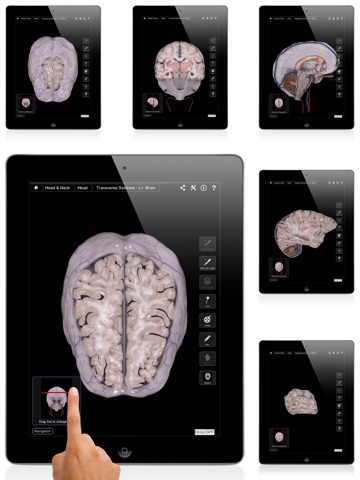 Brain & Nervous System Pro III screenshot 2