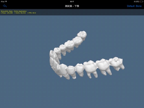 DentalCT screenshot 4