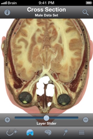 Pocket Brain－インタラクティブ神経解剖学のおすすめ画像3