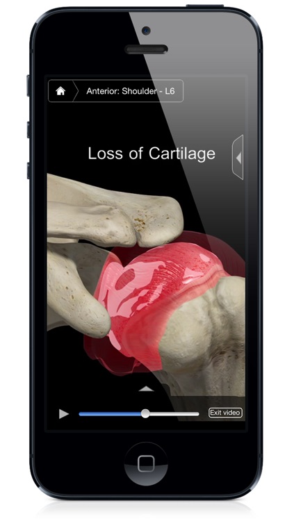 Shoulder Pro III with Animations - iPhone Edition screenshot-4