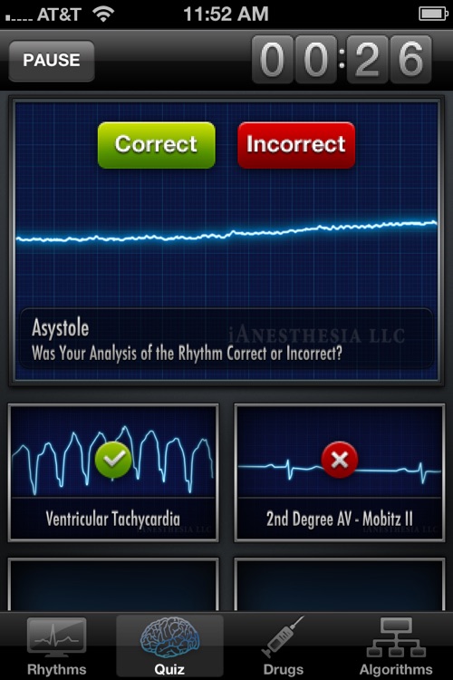 ACLS Rhythms - Resuscitation Guidelines & ECG Advisor screenshot-4