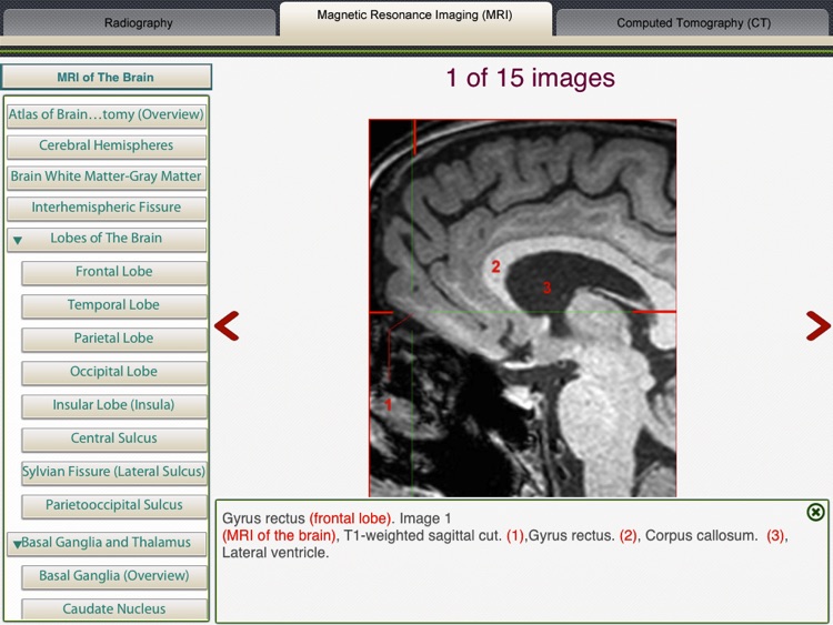 MRI-Xray Human Body